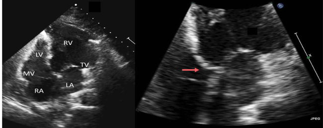 <p>What are these images of?</p>