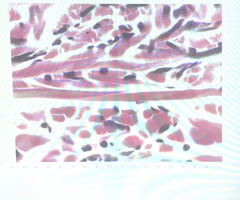 term image