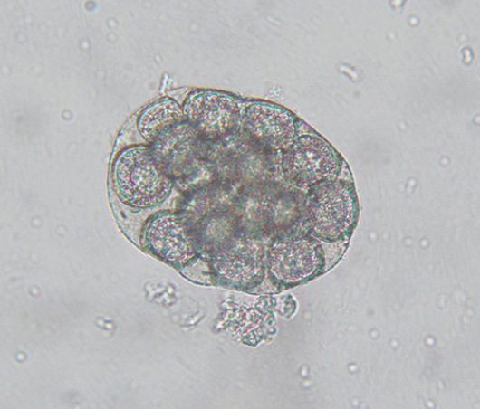 <p>In feces or on fecal flotation of dogs or cats</p>