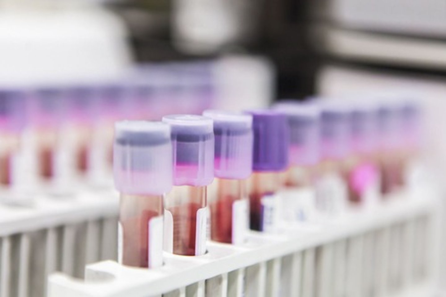 <p>To reduce the risk of transfusion-transmitted infections such as HIV, HCV, and HBV</p>