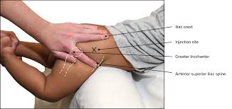 <p>IM Sites: Ventrogluteal</p>