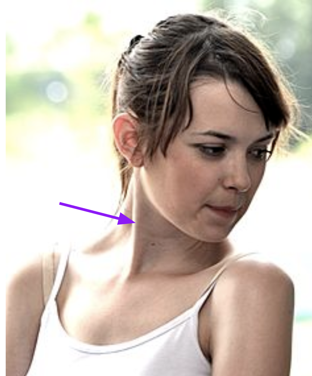<p>Structure: Sternocleidomastoid</p><p>Function: Rotate and flex the head</p><p>origin: sternum + clavicle</p><p>inserstion: Mastoid process temporal</p>
