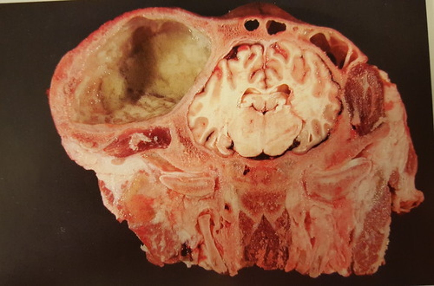 <p>Hoved fra okse. Patoanatomisk diagnose?</p>