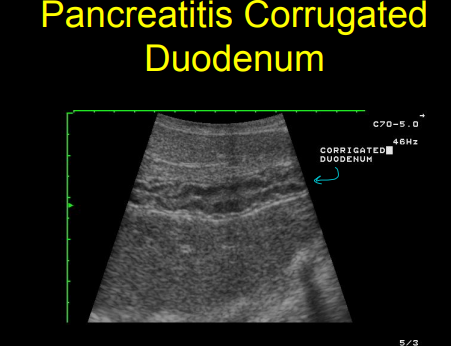 <ul><li><p>Can find in<strong> 50%</strong> of time</p></li><li><p><strong>Right</strong> lobe is <strong>medial</strong> to descending <strong>duodenum</strong></p></li><li><p><strong>Left </strong>lobe is <strong>caudal </strong>to<strong> stomach</strong>, <strong>cranial</strong> to<strong> colon</strong></p></li><li><p><strong>Pancreatitis</strong></p><ul><li><p><strong>US</strong> better than rads</p></li><li><p>Moderate to severe to be seen</p></li><li><p><strong>complex</strong>, mixed echogenic <strong>masses, free fluid</strong></p></li><li><p>Secondary <strong>biliary stasis</strong> and <strong>paralytic ileus</strong> of descending duodenum</p></li></ul></li><li><p><strong>Pancreatic neoplasia and abscesses</strong></p><ul><li><p>insulinoma - sensitivity is poor</p></li><li><p>adenocarcinoma</p></li></ul></li></ul><p></p>