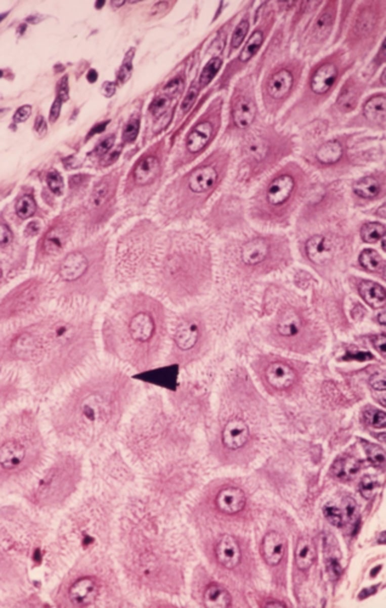 <p>Identify the membrane modification indicated by the arrow.</p>