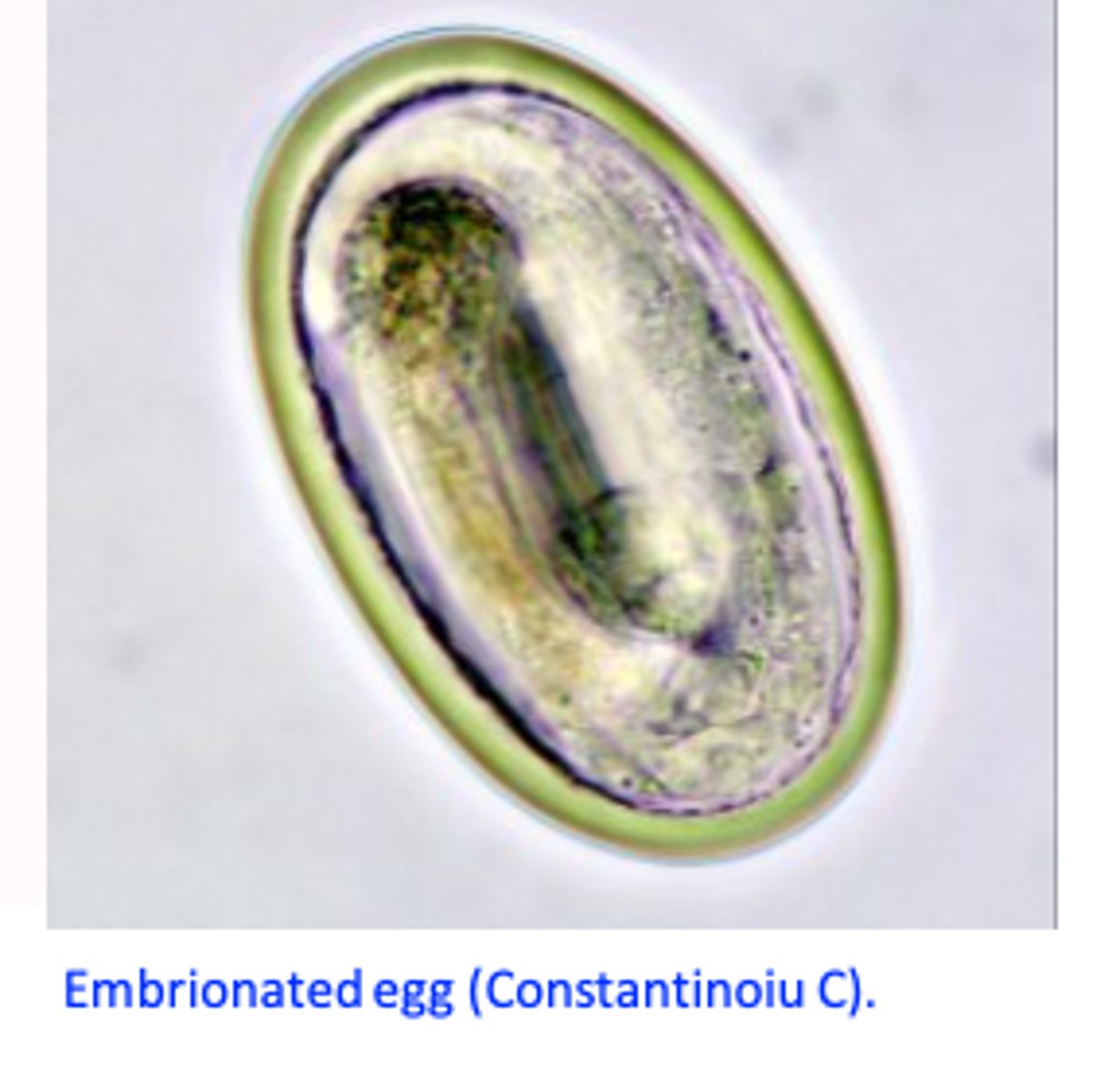 <p>Infection of the birds:</p><p>a) Ingestion of embrionated eggs of Heterakis gallinarum that contain Histomonas meleagridis;</p><p>b) Ingestion of earthworms that contain larvae of Heterakis gallinarum infected with Histomonas meleagridis;</p><p>In the caeca of the host the histomonads multiply (binary fission) and in 2-3 days enter the bloodstream and reach the liver;</p>