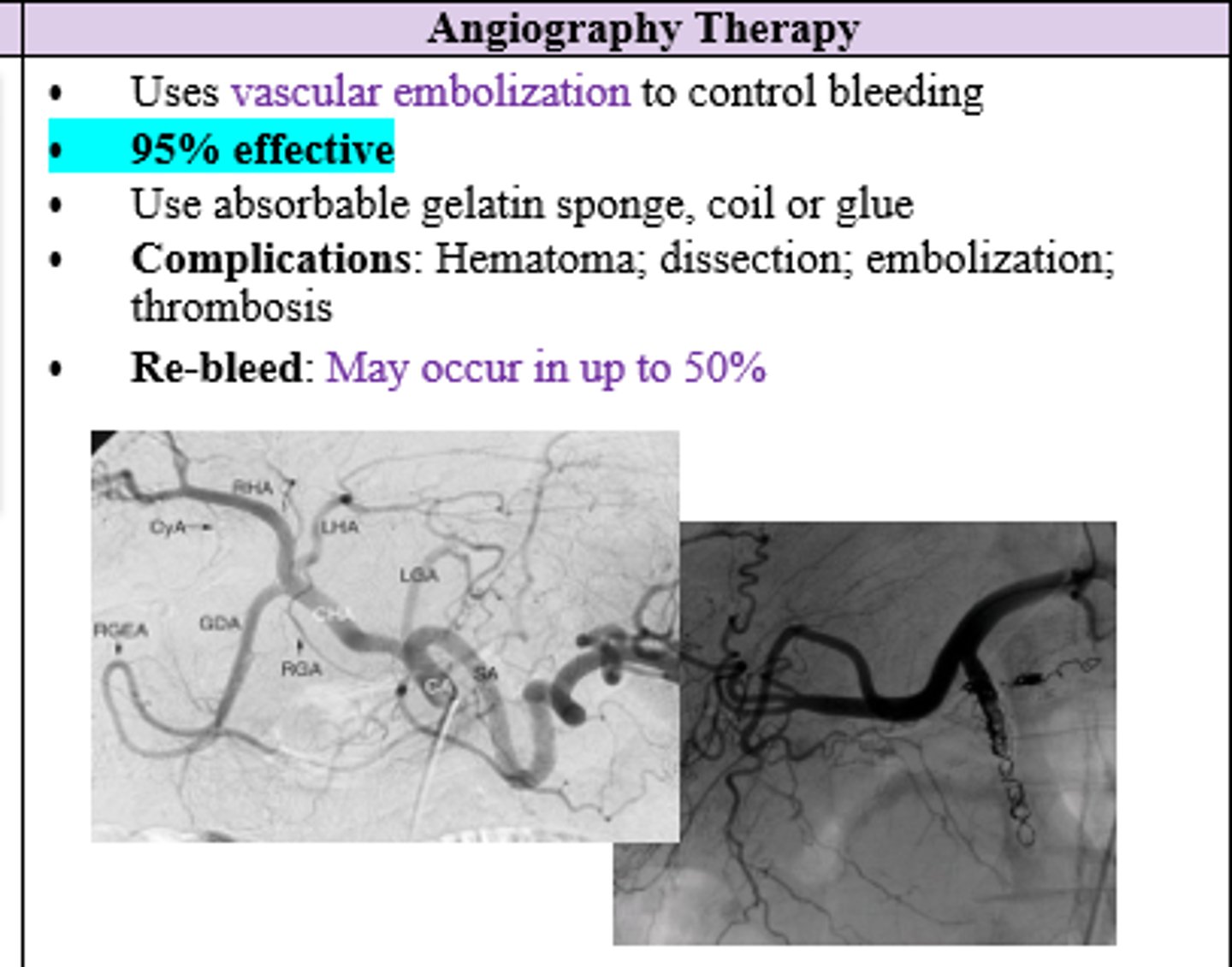 <p>Angiography Therapy (uses vascular embolization) </p>