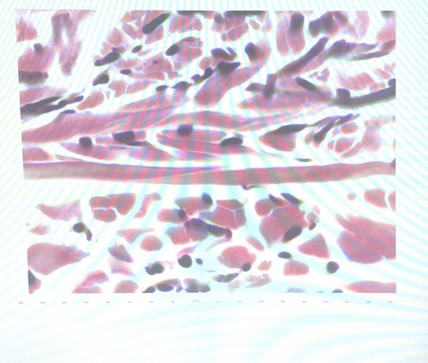 <p>Found in the dermis, fibrous coverings surrounding organs and joints</p>