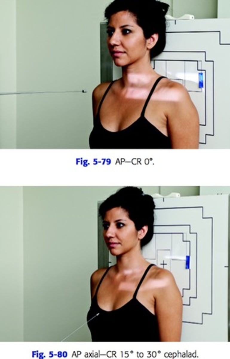 <p>patient standing with back to IR</p><p>CR perpendicular to IR and centered at mid clavicle</p>