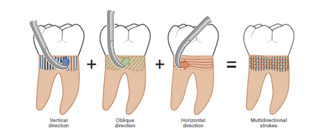 <p>create a grid that covers the entire root surface when instrumenting on root surfaces </p>