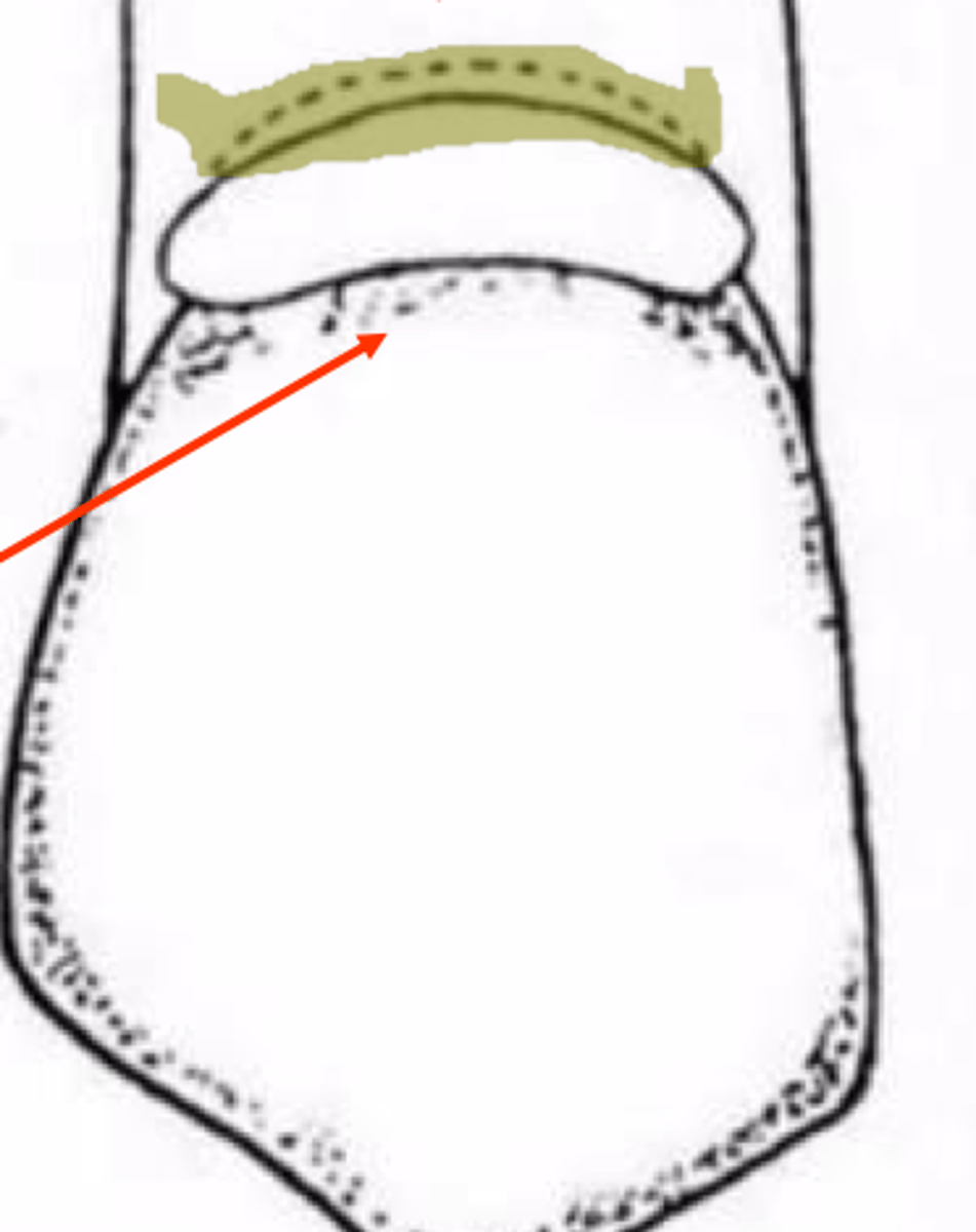 <p>gingival retention groove</p>