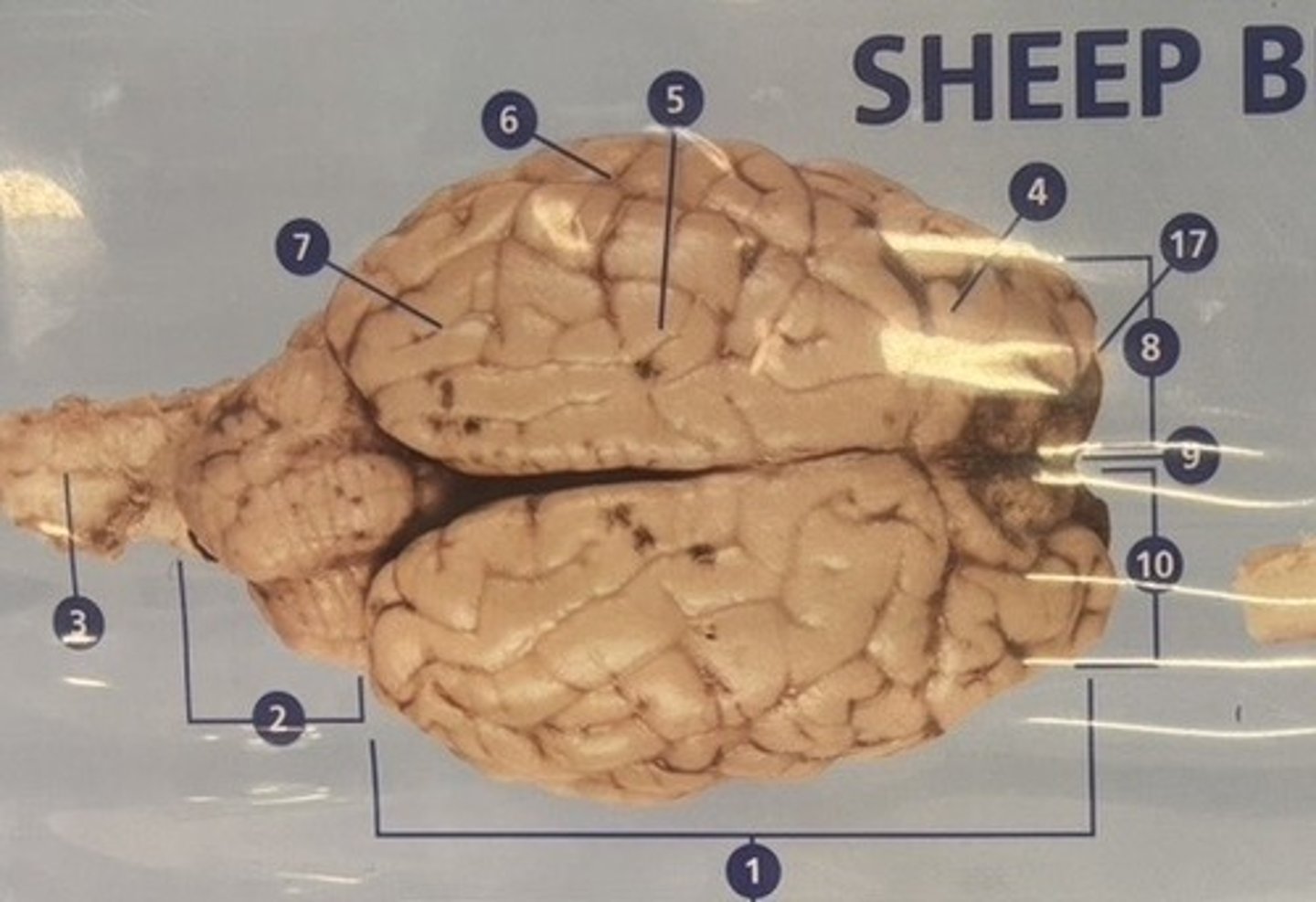 <p>What is number 4?</p>