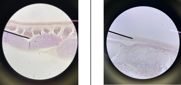 <p>Name this lab epithelium</p>