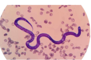 <p>Prepatent period of <span>Dirofilaria immitis</span></p>
