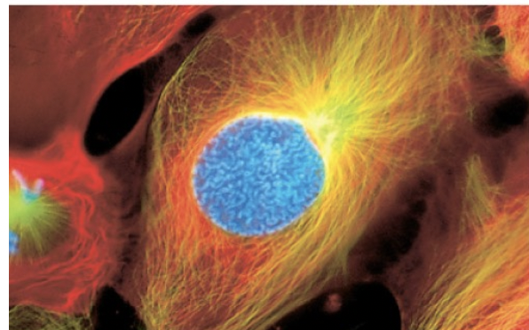 <p>-chromosomes condense and become visible</p><p>-centrosomes move toward poles</p><p>-nuclei begin to disappear</p>