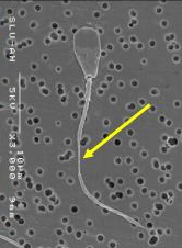 <p>Identify the sperm morphology.</p>
