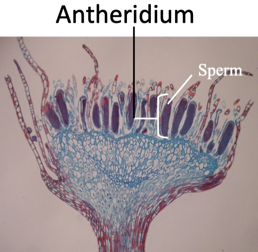 Antheridium and sperm in a moss
