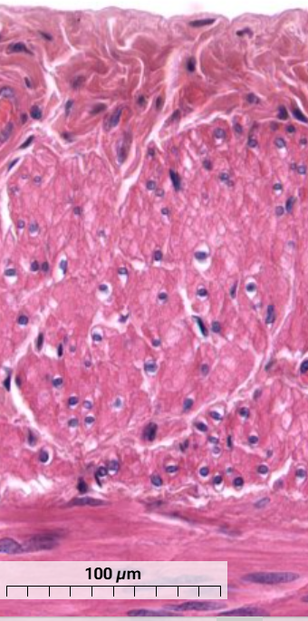 <p>What muscle is this and how can you tell? (transverse section)</p>