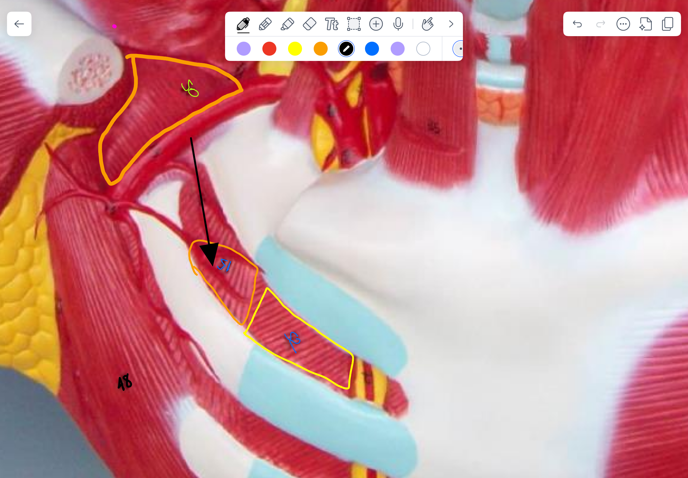 <p>What type of muscle is this ( altay model )</p>