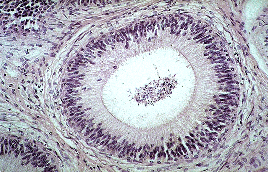 <p>Epididymis</p>