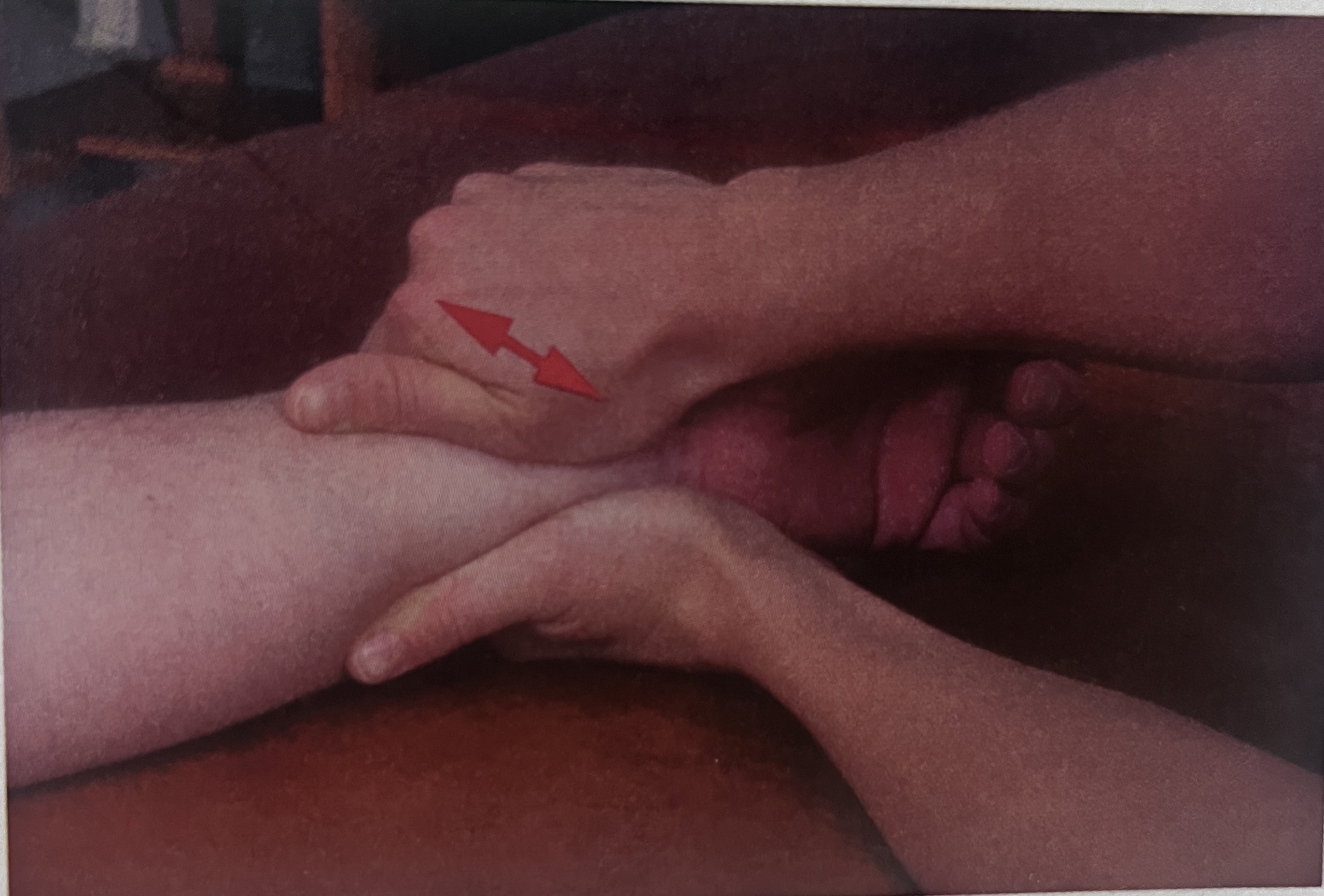 <p>What joint mob is this? ADD STUFF</p>