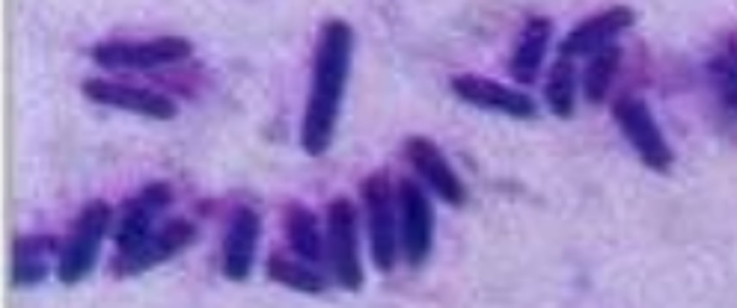 <p>Identify the bacteria's shape.</p>