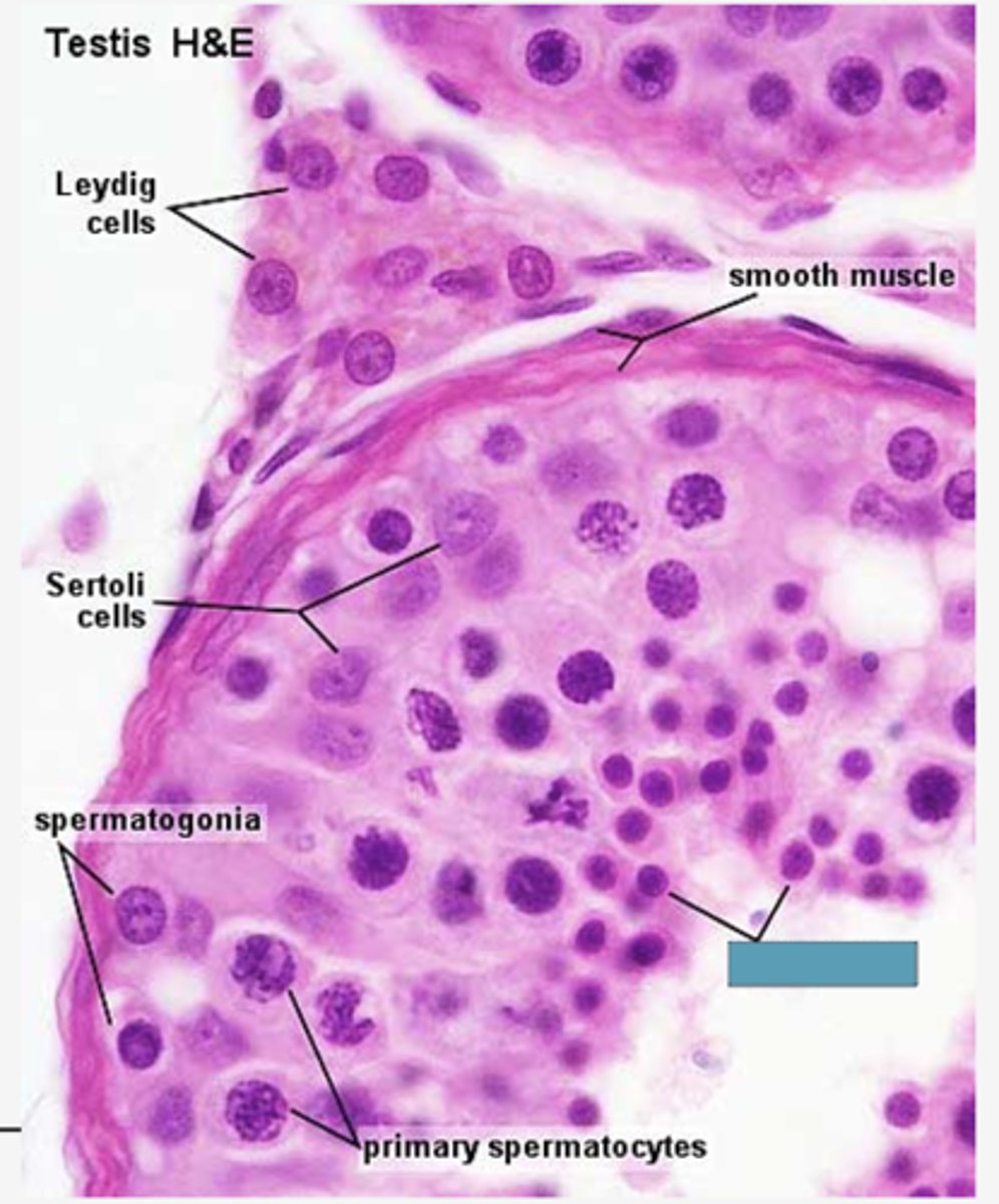 <p>Identify the cells</p>