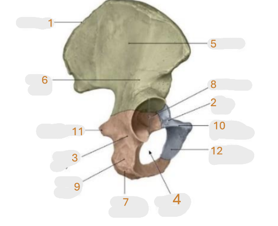 <p>Where is the ischial tuberosity </p>