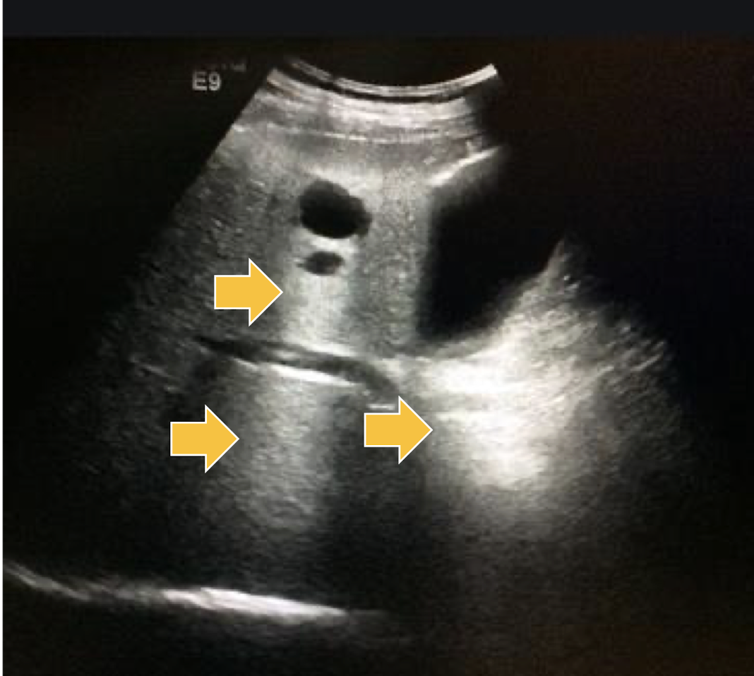 <p>What artifact is this showing?</p>