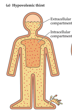 <p>Stimulated by low extracellular/intravascular volume</p><p>not enough water - due to bleeding, sweating, etc.</p><p>caused by actual loss of volume</p>