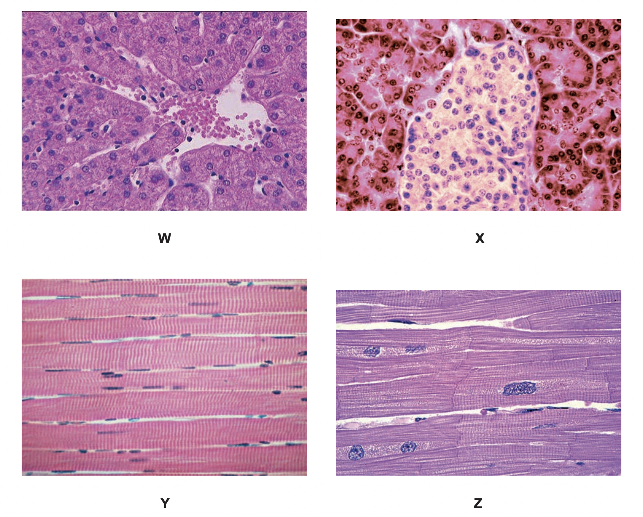 identify tissues W, X, Y