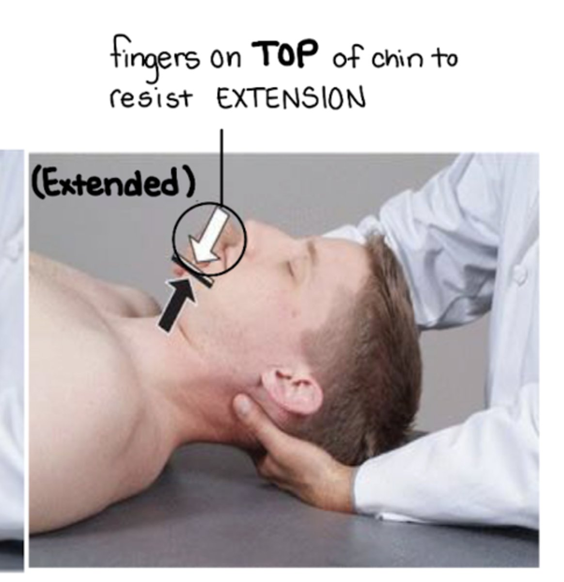 <p>v-hold: under occiput, pads of fingers contact the suboccipital musculature</p><p>pt is moved further into barrier F Sa Ra</p>