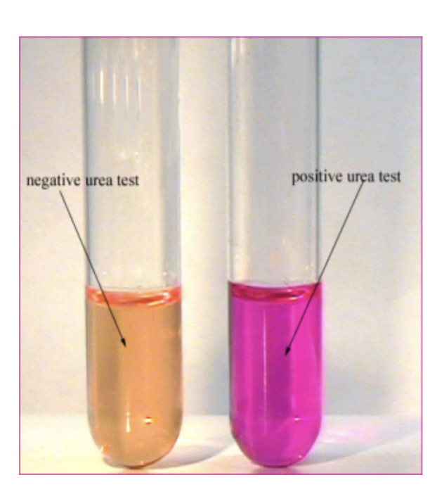 Phenol red is added as a pH indicator

\+ pink (ammonia present = increase pH)

\- no change 
