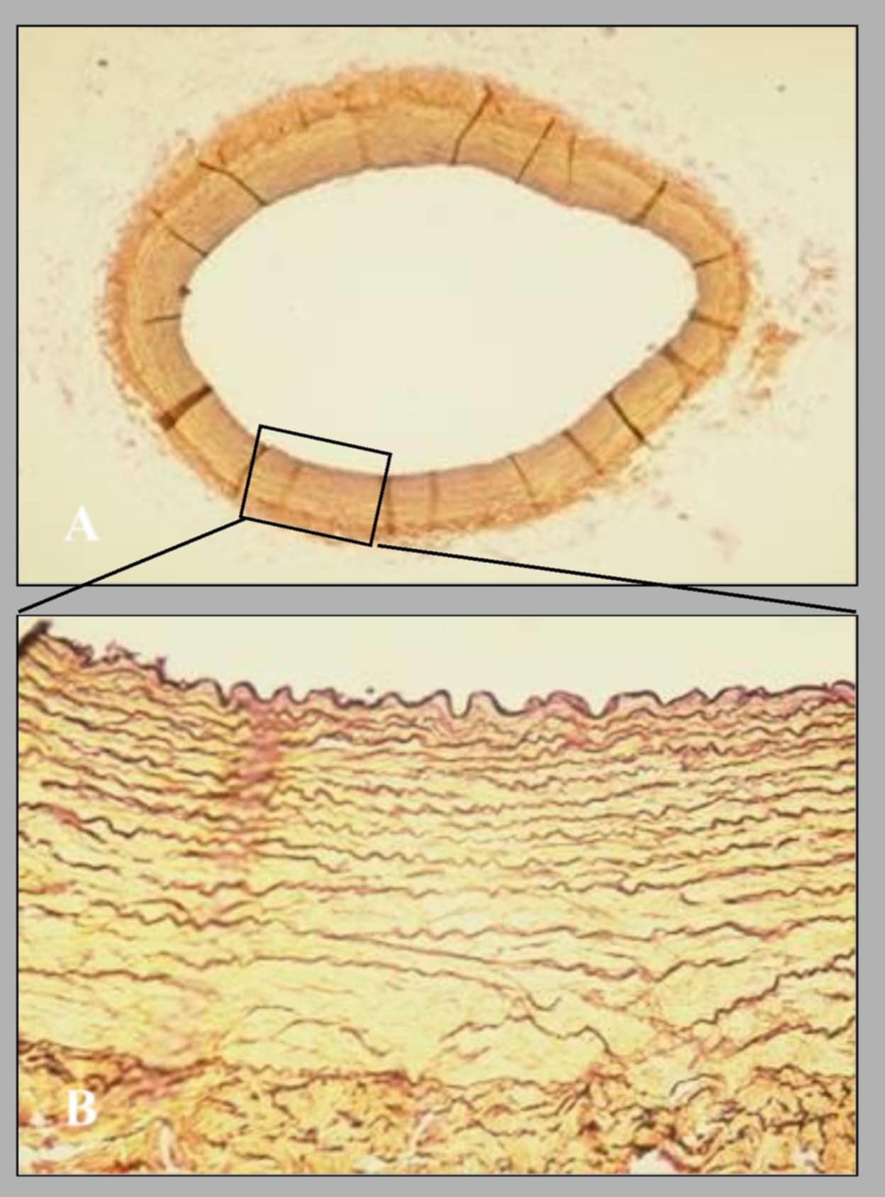<p>name this slide.</p>