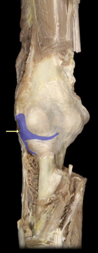 <p>what ligament is this?</p>