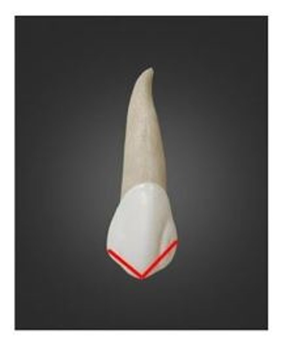 <p>Using the Universal Numbering System, what tooth number is this?</p>