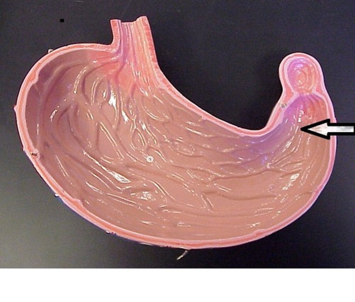 <p>Pylorus (gatekeeper of the stomach)</p>