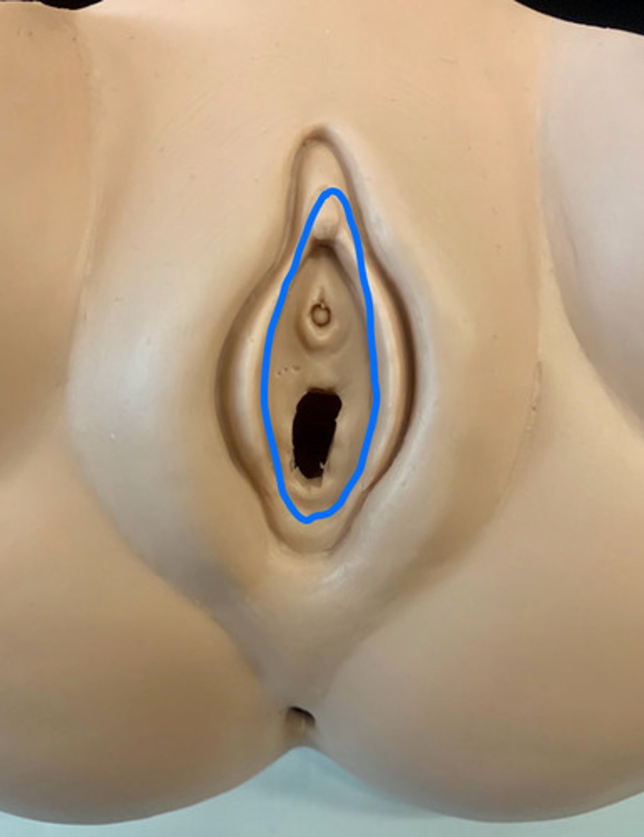 <p>ID Structure outlined in Blue</p>