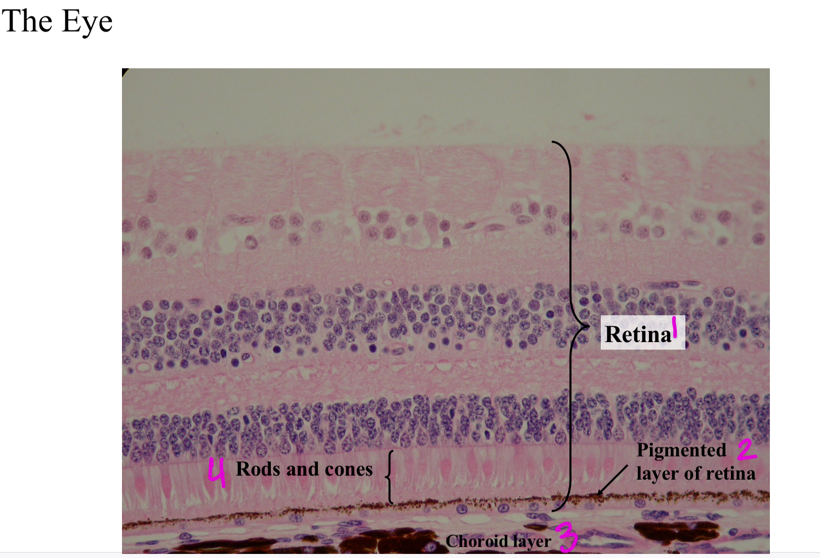 <ol><li><p>Retina</p></li><li><p>Pigmented layer of retina</p></li><li><p>Choroid layer</p></li><li><p>Rods &amp; cones</p></li></ol>