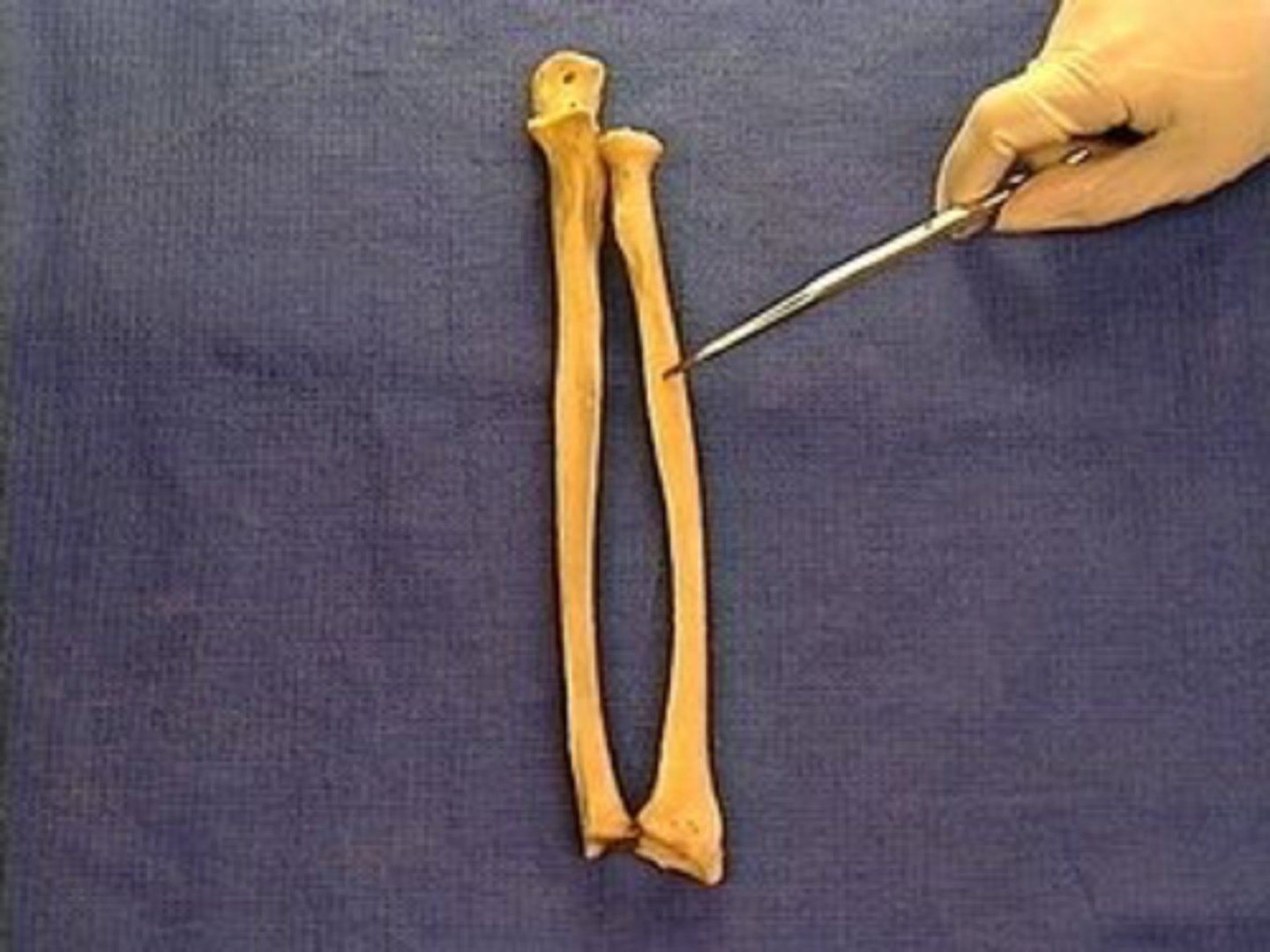 <p>the compressed part of the radius that has cranial and caudal surfaces and medial and lateral borders</p>