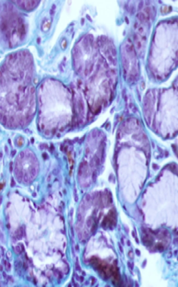 <p>what type of glands are shown</p>
