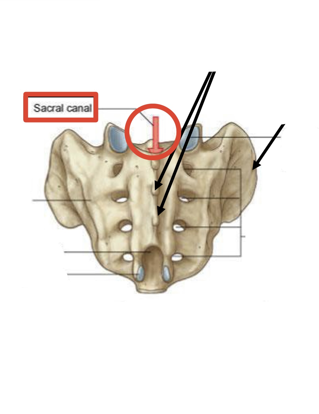 <p><span><span>Sacral canal</span></span></p>