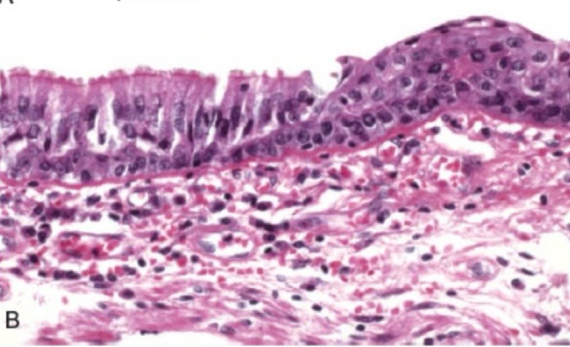 <p>what type of cell adaptation is depicted</p>