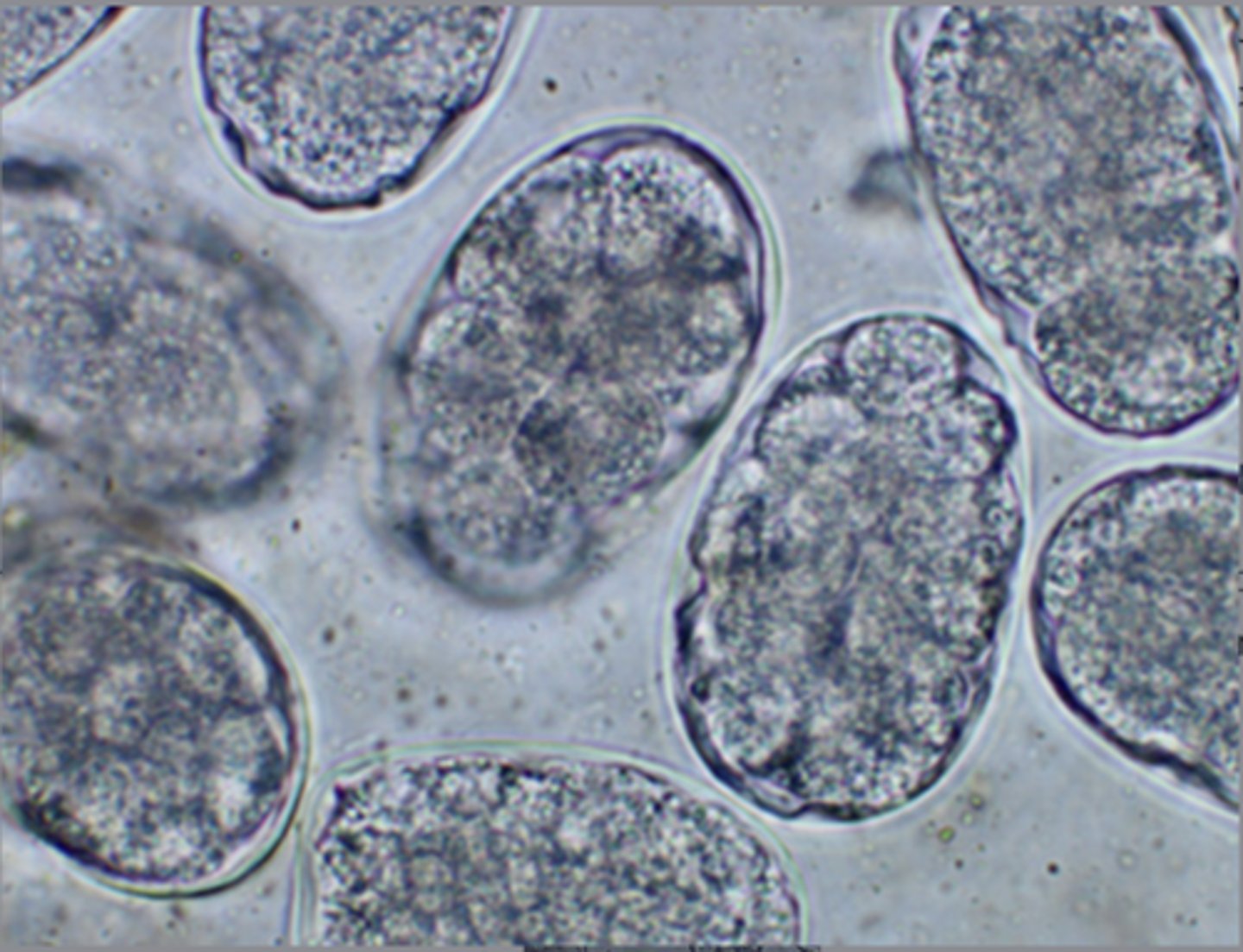 <p>These eggs were found on the fecal flotation of a 10-day-old puppy. They measure approximately 60 x 40 um. How was the puppy infected?</p>