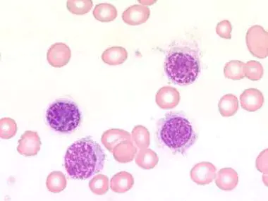 <p>What could these cells indicate?</p>