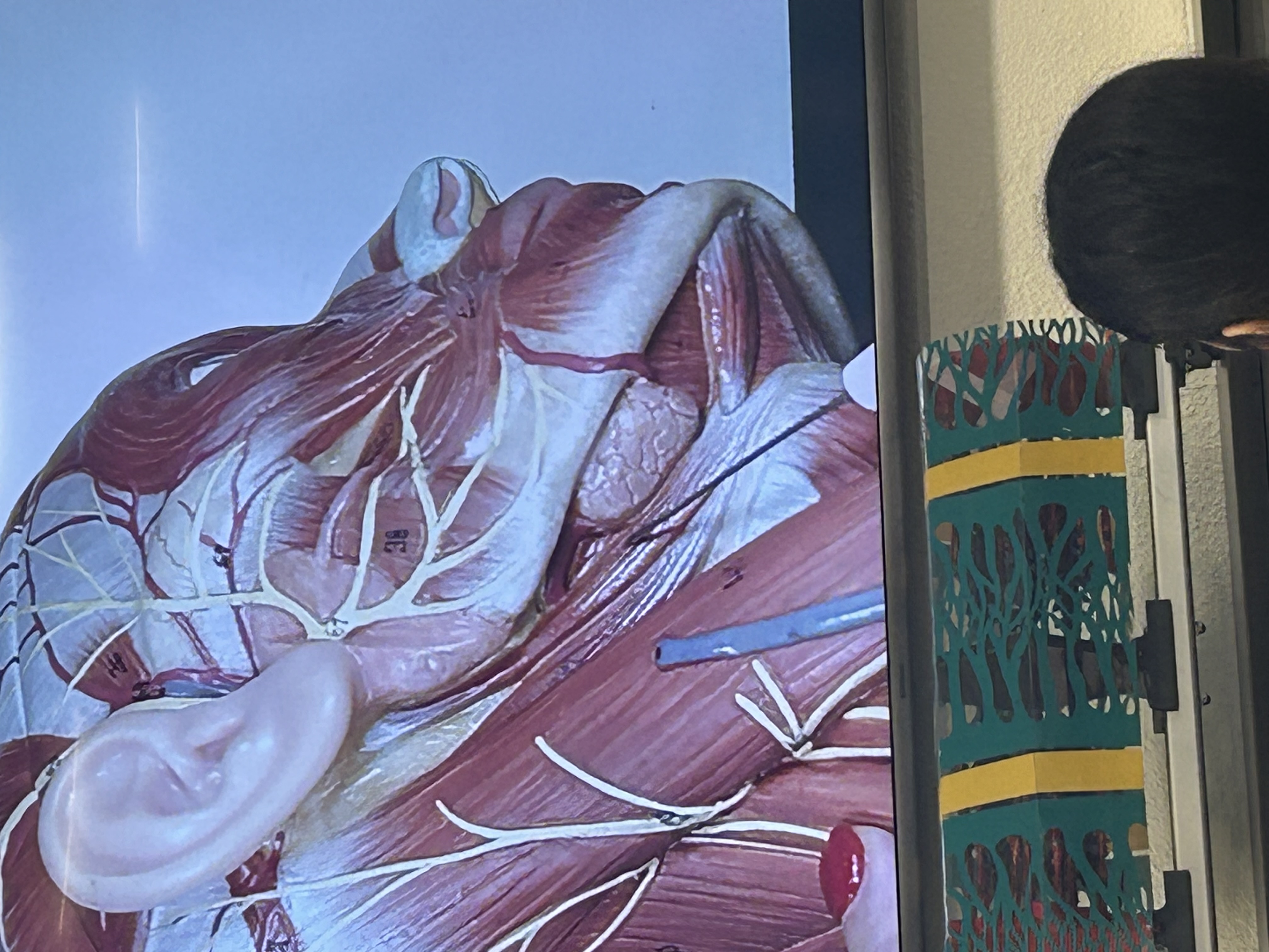 <p>What muscle is this?</p>