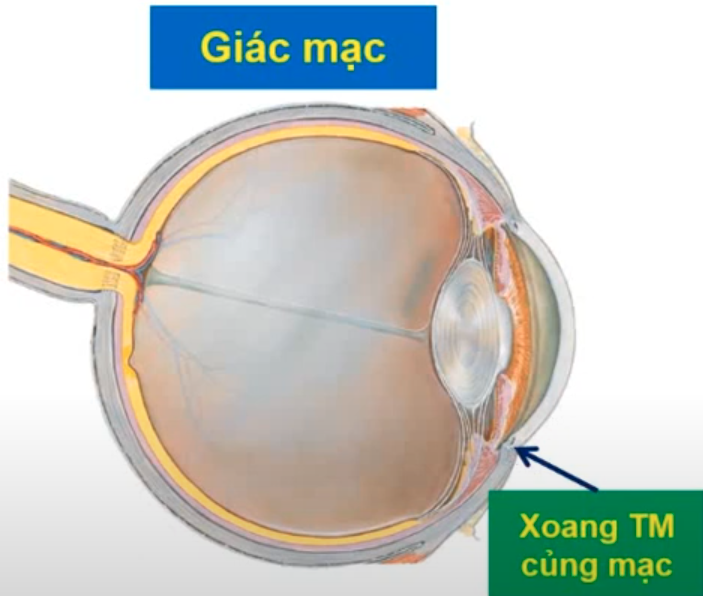 <p><span style="color: blue"><strong>Giác mạc</strong></span> là gì ? </p><p><span style="color: blue"><strong>Củng mạc </strong></span><span style="color: #000000">là gì và đ</span>ược cấu tạo bởi 3 lớp nào ? </p>