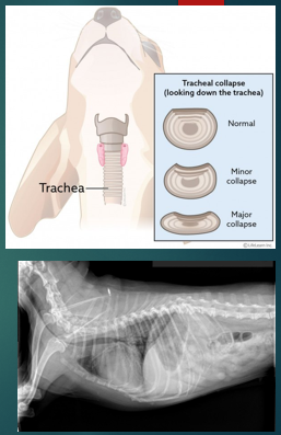<p>What is tracheal collapse? </p>