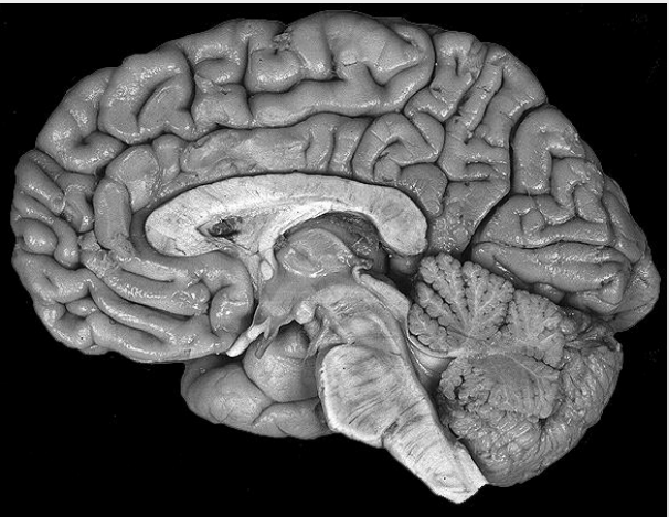 <p>What is Sagittal?</p>