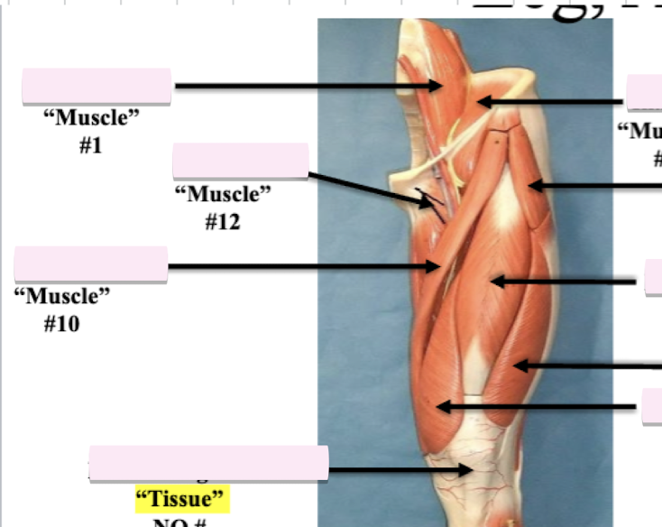 <p>Label muscle #1 </p>